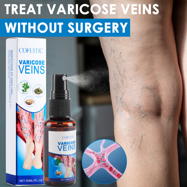 Spray Miraculos Cofultic pentru Varice – Picioare Ușoare, Frumoase și Fără Vârice! ✨